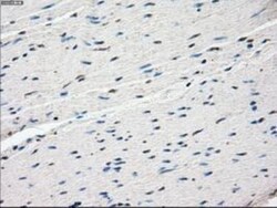FRA-1/FOSL1 Antibody (OTI12F9), Novus Biologicals 0.1mL; Unlabeled:Antibodies,
