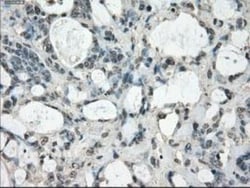 FRA-1/FOSL1 Antibody (OTI12F9), Novus Biologicals 0.1mL; Unlabeled:Antibodies,