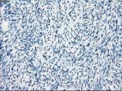 FRA-1/FOSL1 Antibody (OTI12F9), Novus Biologicals 0.1mL; Unlabeled:Antibodies,