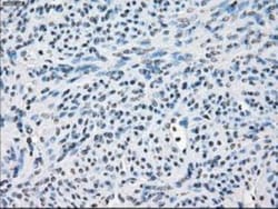 FRA-1/FOSL1 Antibody (OTI12F9), Novus Biologicals 0.1mL; Unlabeled:Antibodies,