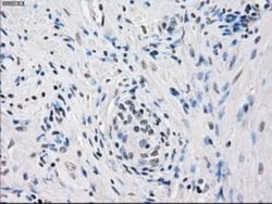 FRA-1/FOSL1 Antibody (OTI12F9), Novus Biologicals 0.1mL; Unlabeled:Antibodies,