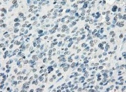 FRA-1/FOSL1 Antibody (OTI12F9), Novus Biologicals 0.1mL; Unlabeled:Antibodies,