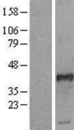 Novus Biologicals&trade;&nbsp;FRA2 Overexpression Lysate