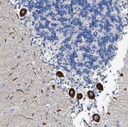 FRAS1 Related Extracellular Matrix 3 Antibody, Novus Biologicals 0.1mL;