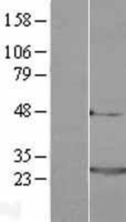 Novus Biologicals™ Frequenin Overexpression Lysate
