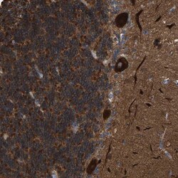Frequenin Antibody, Novus Biologicals 0.1mL; Unlabeled:Antibodies, Polyclonal