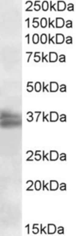 FRG1 Antibody, Novus Biologicals 0.1mg; Unlabeled:Antibodies, Polyclonal