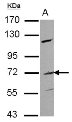 anti-Frizzled-1, Polyclonal, Novus Biologicals 0.1mL; Unlabeled:Antibodies,