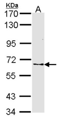 Frizzled-10 Antibody, Novus Biologicals 0.1mL; Unlabeled:Antibodies, Polyclonal