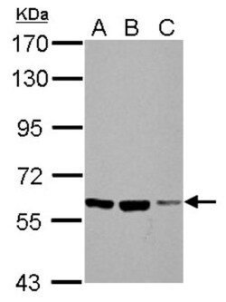 Frizzled-10 Antibody, Novus Biologicals 0.1mL; Unlabeled:Antibodies, Polyclonal