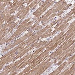Frizzled-2 Antibody, Novus Biologicals 0.1mL; Unlabeled:Antibodies, Polyclonal