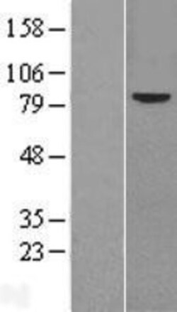 Novus Biologicals™ Frizzled-6 Overexpression Lysate
