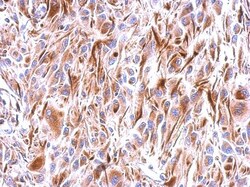 Frizzled-9 Antibody, Novus Biologicals 0.1mL; Unlabeled:Antibodies, Polyclonal