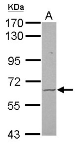 Frizzled-9 Antibody, Novus Biologicals 0.1mL; Unlabeled:Antibodies, Polyclonal
