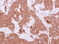 Frk Antibody, Novus Biologicals 0.1mL; Unlabeled:Antibodies, Polyclonal