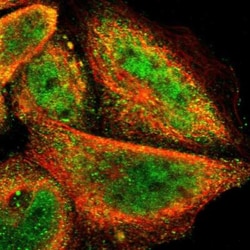 FRMD7 Antibody, Novus Biologicals 25 &mu;L, Unlabeled:Antibodies, Polyclonal
