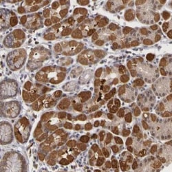 FRMD7 Antibody, Novus Biologicals 25 &mu;L, Unlabeled:Antibodies, Polyclonal