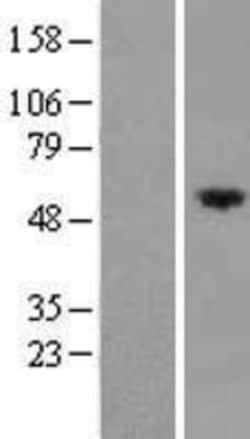 Novus Biologicals&trade;&nbsp;FRMD8 Overexpression Lysate