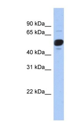 FRS3 Antibody, Novus Biologicals 100&mu;L; Unlabeled:Antibodies, Polyclonal