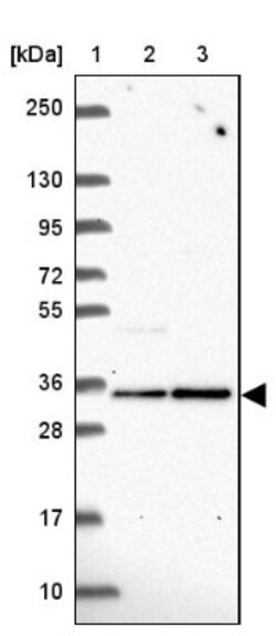 Fructosamine-3-kinase-related Antibody, Novus Biologicals 25 &mu;L, Unlabeled:Antibodies,