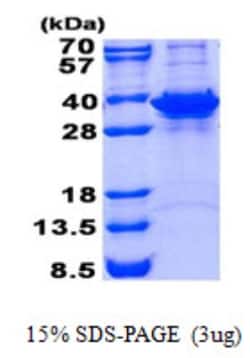 Novus Biologicals&trade;&nbsp;Recombinant Human Fructosamine-3-kinase-related His Protein