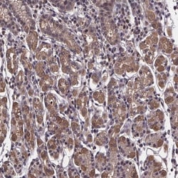 Fructosamine-3-kinase-related Antibody, Novus Biologicals 25 &mu;L, Unlabeled:Antibodies,