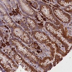 FRY Antibody, Novus Biologicals:Antibodies:Primary Antibodies