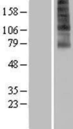 Novus Biologicals&trade;&nbsp;FSCN3 Overexpression Lysate