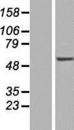 Novus Biologicals&trade;&nbsp;FSD1 Overexpression Lysate