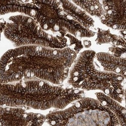 AGAP3 Antibody, Novus Biologicals:Antibodies:Primary Antibodies