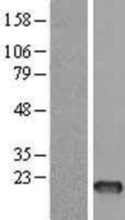 Novus Biologicals&trade;&nbsp;FSH beta Overexpression Lysate