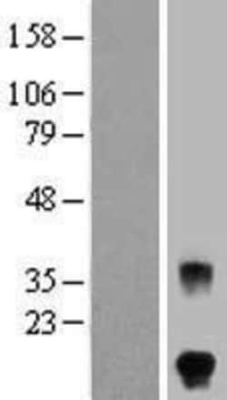 Novus Biologicals&trade;&nbsp;FSH beta Overexpression Lysate