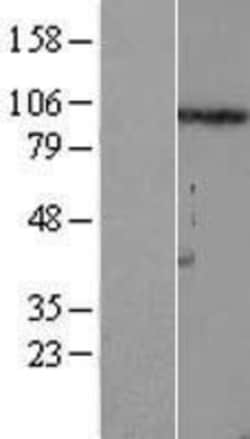 Novus Biologicals™ FSTL5 Overexpression Lysate