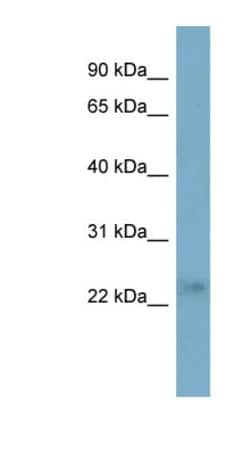 FTHL17 Antibody, Novus Biologicals 100&mu;L; Unlabeled:Antibodies, Polyclonal