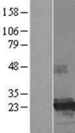 Novus Biologicals™ FTHL17 Overexpression Lysate
