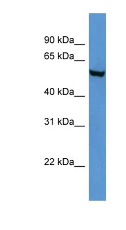 FTO Antibody, Novus Biologicals 0.05mg; Unlabeled:Antibodies, Polyclonal