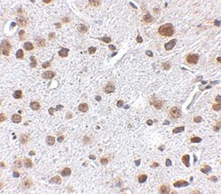 FTO Antibody - BSA Free, Novus Biologicals 0.1mg; Unlabeled:Antibodies,
