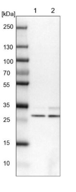FTS Antibody, Novus Biologicals 0.1mL; Unlabeled:Antibodies, Polyclonal
