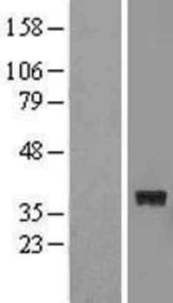 Novus Biologicals&trade;&nbsp;FTSJ1 Overexpression Lysate