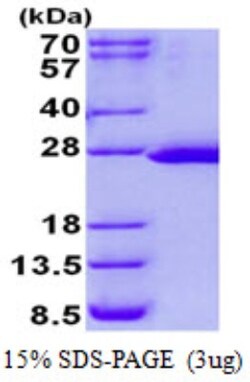 Novus Biologicals&trade;&nbsp;Recombinant Human FTSJ2 His Protein