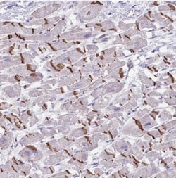 FTSJ2 Antibody, Novus Biologicals 0.1 mL | Buy Online | Novus Biologicals | Fisher Scientific