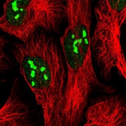 FTSJ3 Antibody, Novus Biologicals:Antibodies:Primary Antibodies