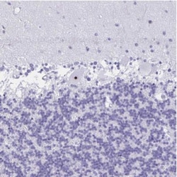 FTSJ3 Antibody, Novus Biologicals:Antibodies:Primary Antibodies