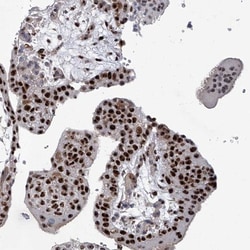 FTSJD2 Antibody, Novus Biologicals 25 &mu;L | Buy Online | Novus Biologicals | Fisher Scientific