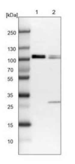 FTSJD2 Antibody, Novus Biologicals 25 &mu;L; Unlabeled:Antibodies, Polyclonal