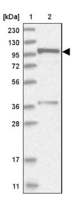FTSJD2 Antibody, Novus Biologicals 25 &mu;L | Buy Online | Novus Biologicals | Fisher Scientific