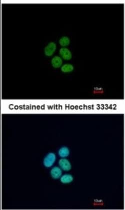 FUBP1 Antibody, Novus Biologicals 0.1mL; Unlabeled:Antibodies, Polyclonal