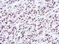 FUBP1 Antibody, Novus Biologicals 0.1mL; Unlabeled:Antibodies, Polyclonal