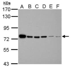 FUBP1 Antibody, Novus Biologicals 0.1mL; Unlabeled:Antibodies, Polyclonal