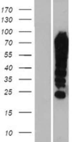 Novus Biologicals&trade;&nbsp;FUBP1 Overexpression Lysate